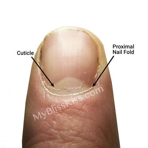 Bad Cuticles Vs Good Cuticles | ubicaciondepersonas.cdmx.gob.mx