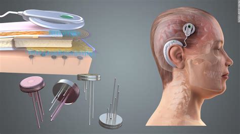 Brain implants could give governments and companies power to read your mind, scientists warn - CNN