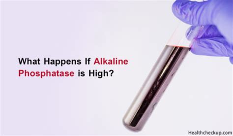 Alkaline Phosphatase High Symptoms, Causes, Treatment