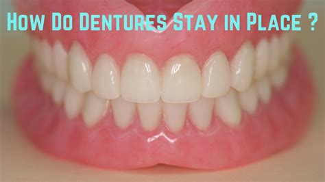 How do dentures stay in place - YouTube