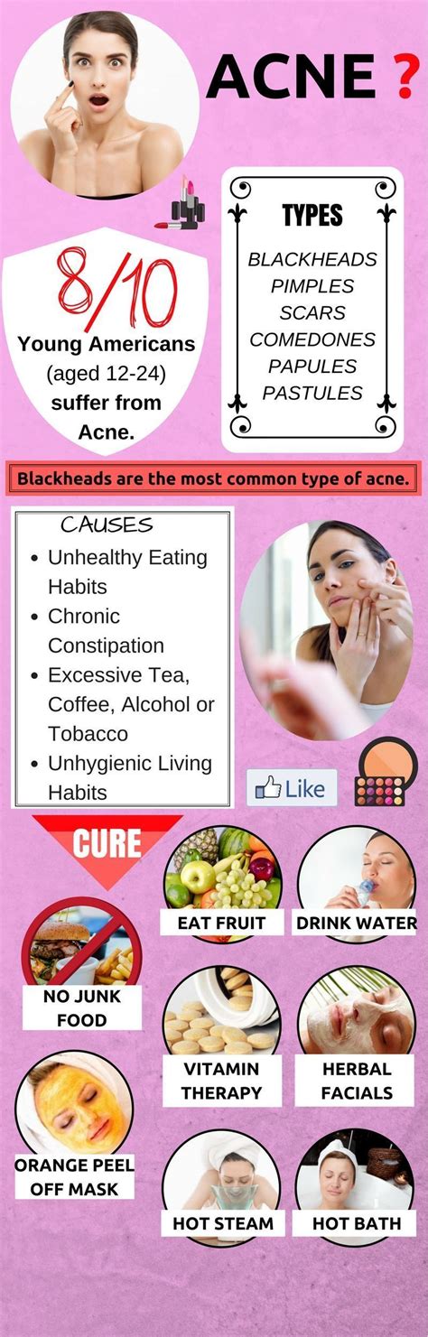 Pin on Acne Remedies Fast