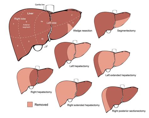 Liver Pictures