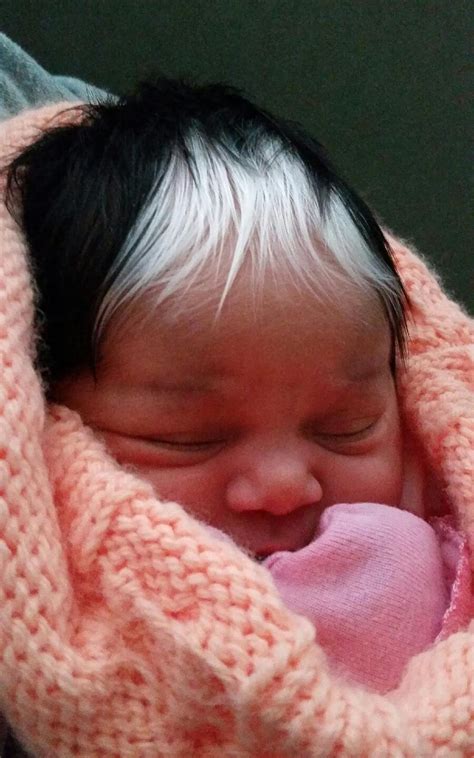 White Hair On Baby : This Baby Was Born With The Same White Hair Streak ...