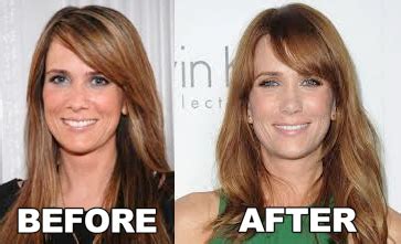 Kristen Wiig Nose Job Before And After Photo ~ Celebrity plastic surgery | Celebrity plastic ...