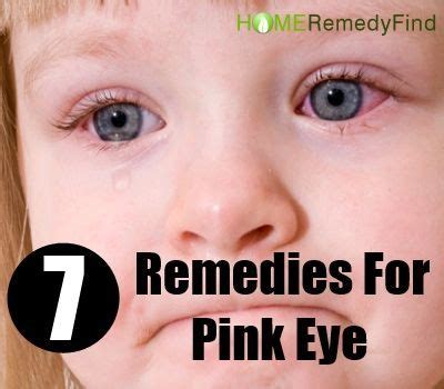7 Amazing Home Remedies For Pink Eye vheck lice add to handout | Pinkeye remedies, Home remedies ...