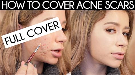 Best Makeup For Skin With Acne Scars | Makeupview.co