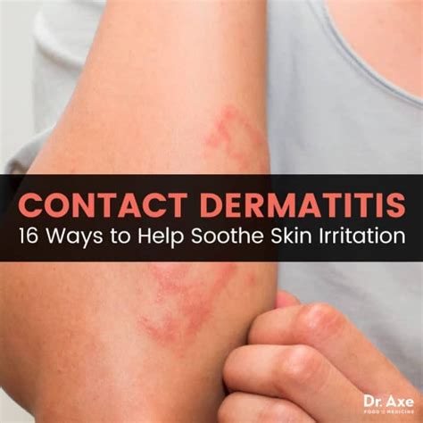 Contact Dermatitis Causes + Natural Treatments - Dr. Axe in 2020 | Contact dermatitis ...