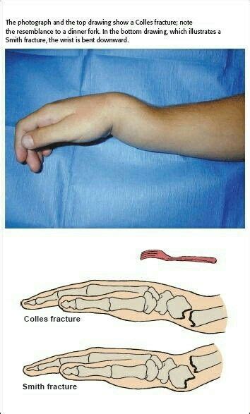 Idea by Kenzie Slinger on Medical Science and Forensics | Radiology student, Radiology, Medical ...