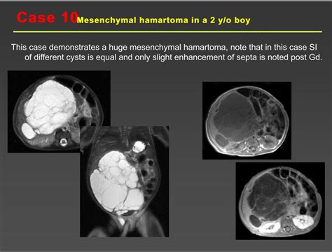 Pin by jbahri on Pediatric radiology | Pediatric radiology, Pediatrics, Radiology