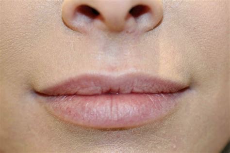Semi Permanent Makeup Lips Before And After | Saubhaya Makeup