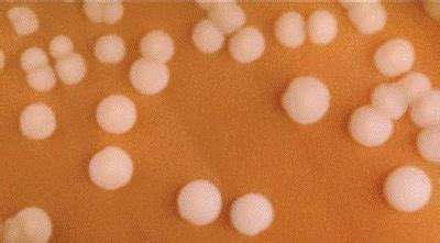 N. meningitidis colonies on a chocolate agar plate 1 | Download ...