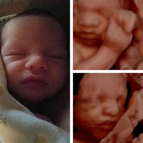 babies with big lips ultrasound - wallpaperhdiphonecrazy