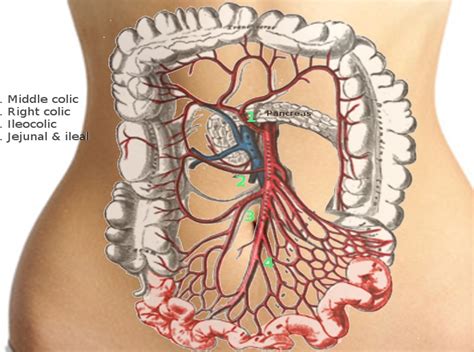 Superior Mesenteric Artery Model