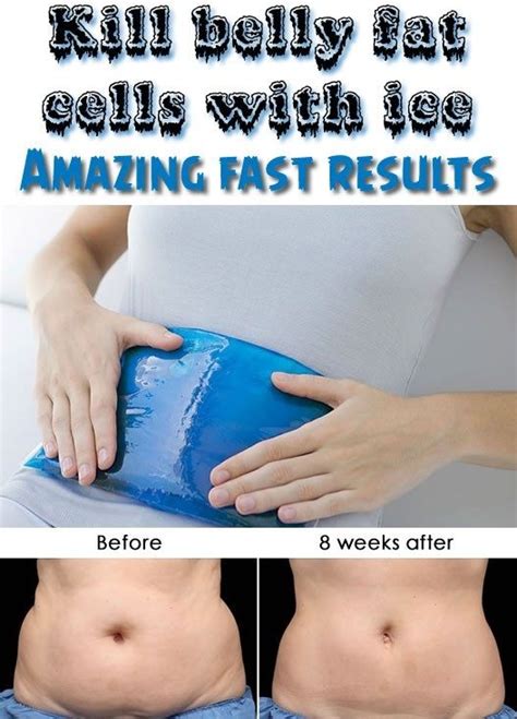 7 Images Freezing Fat Cells At Home With Ice Packs Reviews And ...