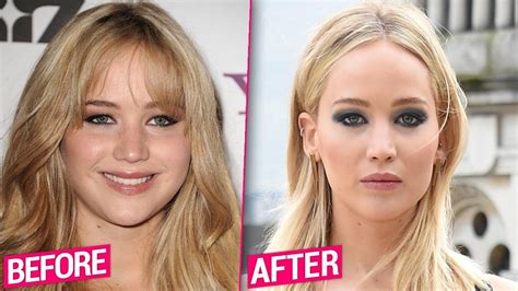 Jennifer Lawrence Before & After Plastic Surgery Makeover Exposed