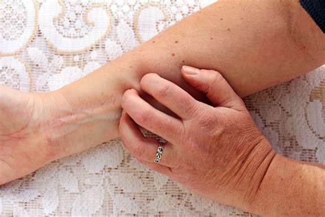 Understanding and Managing Itchy Skin in Older Adults: Causes and Relief - Archyde