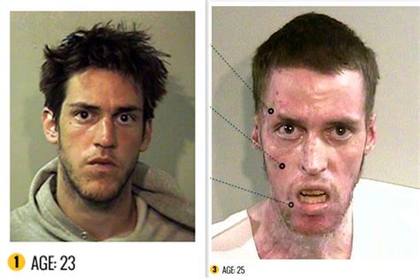 Shocking before and after pictures horrors of crystal meth drug abuse ...