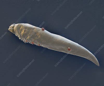 Eyelash mite larva, SEM - Stock Image - C002/5656 - Science Photo Library