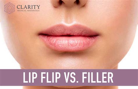 Lip Flip vs. Filler: Everything You Need to Know - Clarity Medical Aesthetics