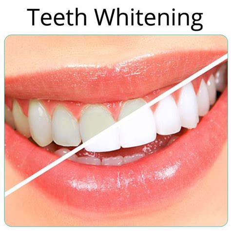 Coconut Oil Teeth Whitening Diy - TeethWalls