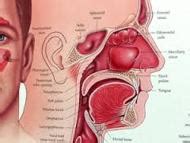 Sinus Infection - Assignment Point