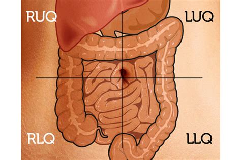 How to assess bowel sounds