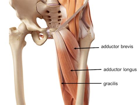 Groin strain