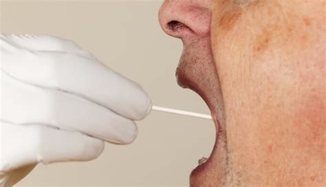 Saliva Test May Distinguish Between Different Forms of Cognitive Decline - Psychiatry Advisor