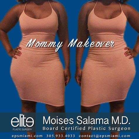 #Mommymakeover by Dr. Salama. A mommy makeover typically involves a #breastenhancement procedure ...