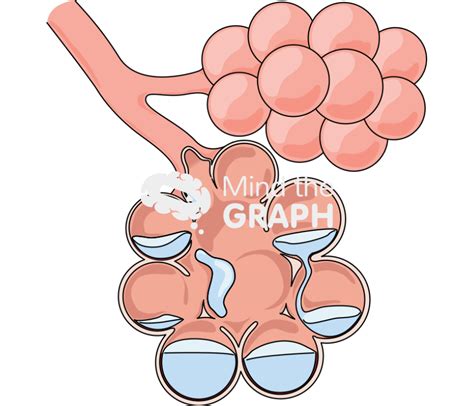 Alveolus pulmonary edema cut - Mind the Graph
