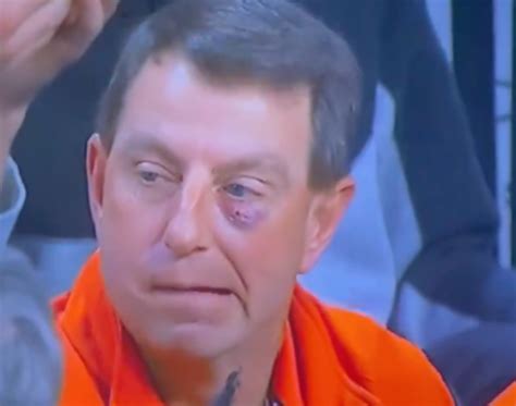 Dabo Swinney Black Eye: Why Clemson Coach Is Going Viral on Saturday ...