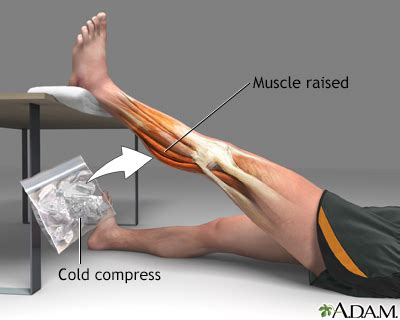 Muscle strain treatment - UF Health