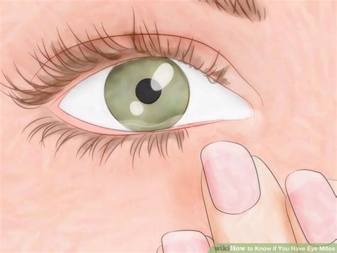 How to Know if You Have Eye Mites: Symptoms & Treatments | Eye mites, Eyelash mites, Mites on humans