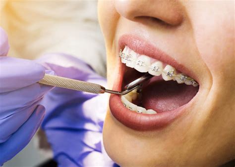 Harken Dental Excellence | Top-Rated Orthodontist in Spokane Valley ...