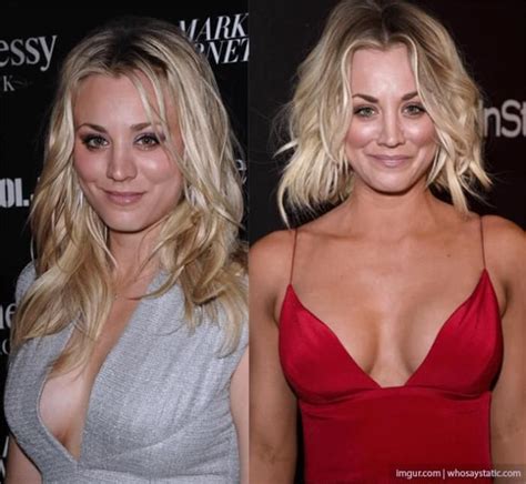 Pin on Kaley Cuoco Plastic Surgery