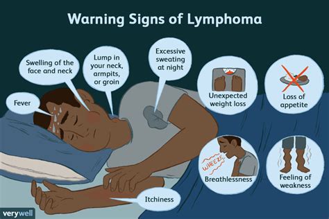 Lymphoma: Signs, Symptoms, and Complications