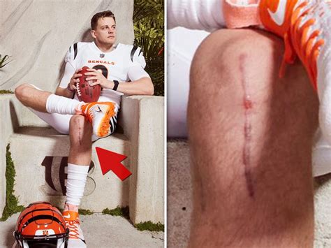 Joe Burrow's Huge, Gnarly ACL Surgery Scar Shown During Bengals' Jersey Reveal