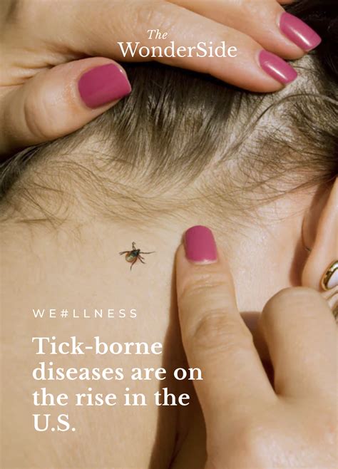 Tick borne diseases are on the rise in the u s – Artofit