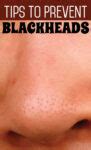 Top 10 Effective Remedies For Blackheads | Ask Remedies