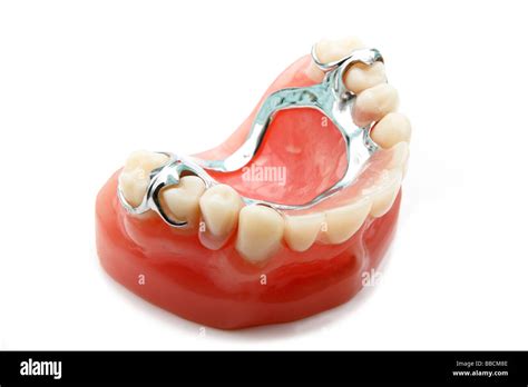 Chrome cobalt denture hi-res stock photography and images - Alamy