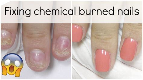 Extremely damaged nail transformation - How to fix it with Polygel | Nails, Acrylic nail shapes ...