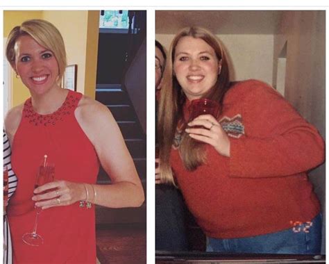 Metformin Weight Loss Pcos Success Stories - WeightLossLook