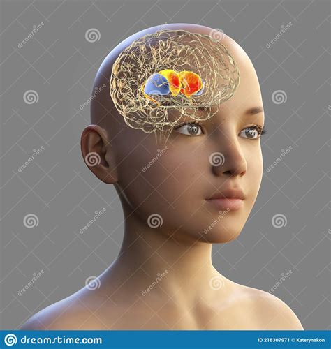 Corpus Striatum X-ray Profile Close-up View 3D Rendering Illustration With Body Contours. Human ...