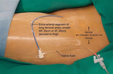 Inguinal Folds Of Groin