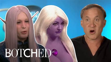 What to Look Forward to in Botched Season 7 | Metro.Style