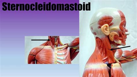 Muscle Actions: Sternocleidomastoid - YouTube