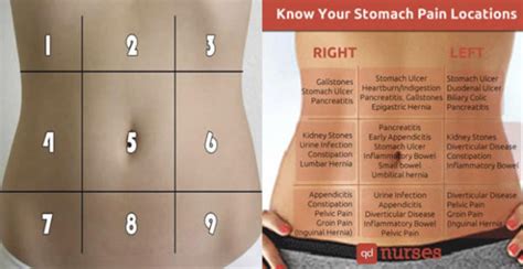 Stomach pain area chart : r/coolguides