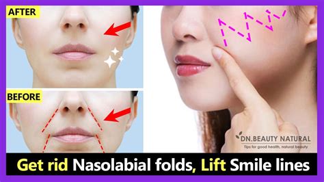 Get rid Smile Wrinkles, Laugh lines, Nasolabial folds, Lift Smile lines | Face Yoga & Massage ...