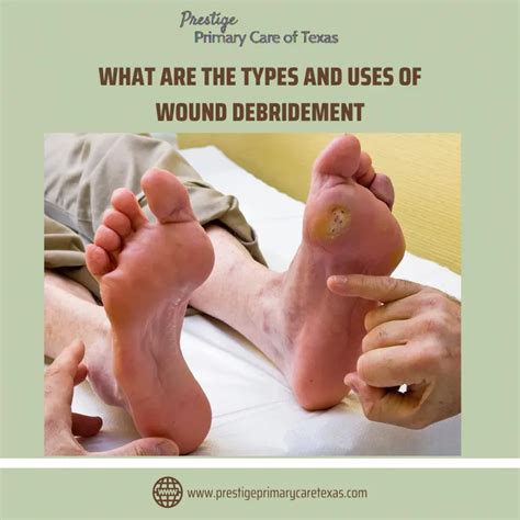 What Are The Types and Uses of Wound Debridement – Dallas, TX | Internal Medicine located in ...