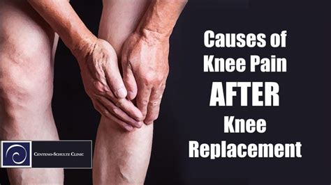 Why Does Knee Replacement May Not Relieve Your Knee Pain?